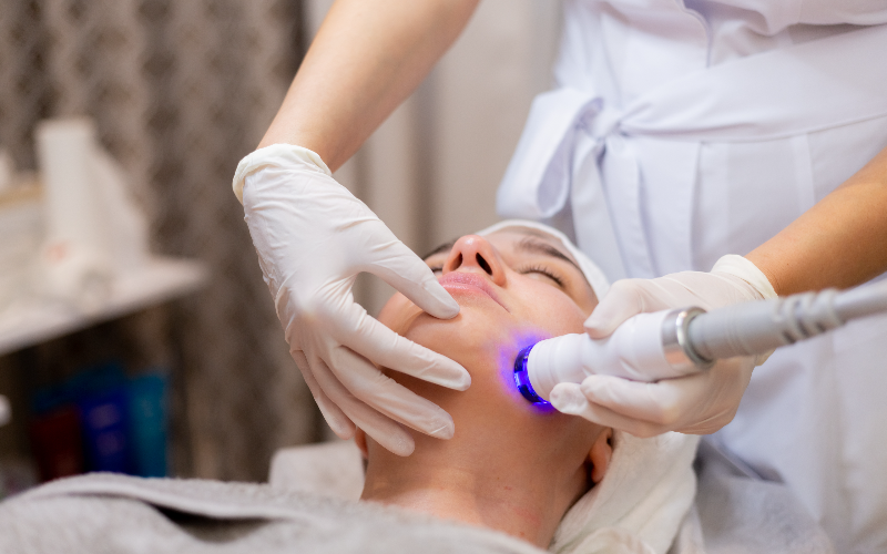 From Dull to Dazzling: How Photofacial IPL Renews Your Skin